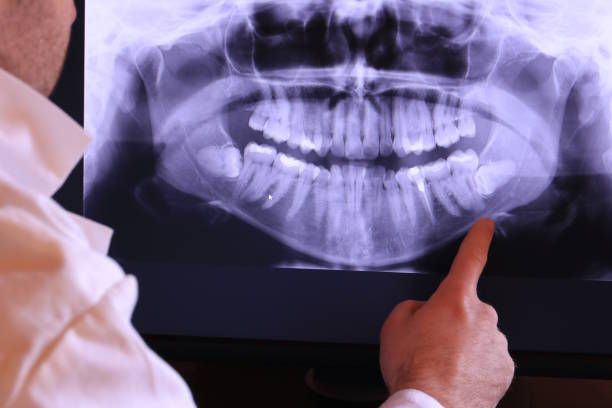 Best Emergency Gum Pain Relief  in Lakeview, OH