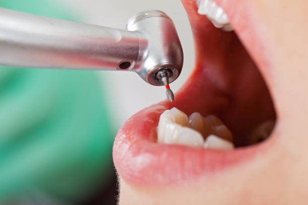 Best Broken Tooth Emergency  in Lakeview, OH